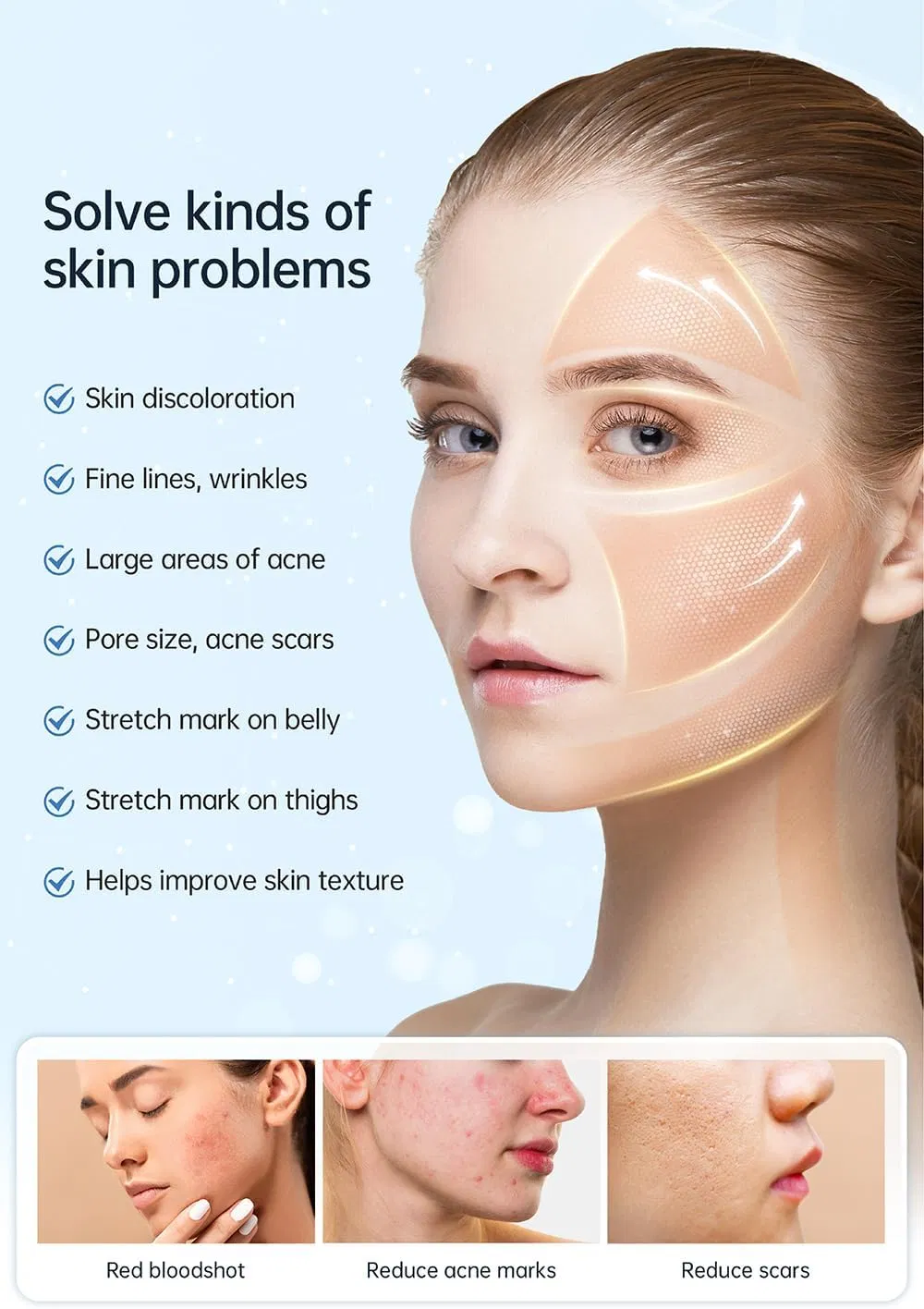 Neuer Hydra Pen H5 Infusionsträger Serum EMS und Mikroneedling Automatische Anwendung 4