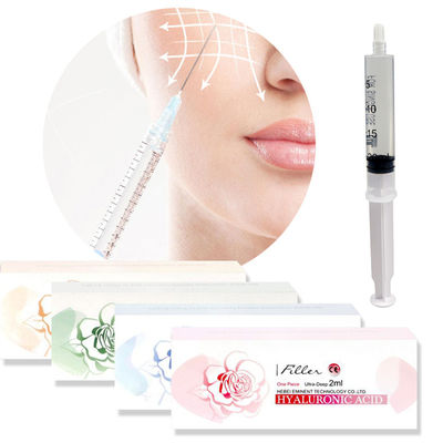Dermales Füllmittel 1ml 2ml 3ml 5ml 10ml 20ml 50ml HA-Füllmittel Hyaluronsäure Injektion Falten