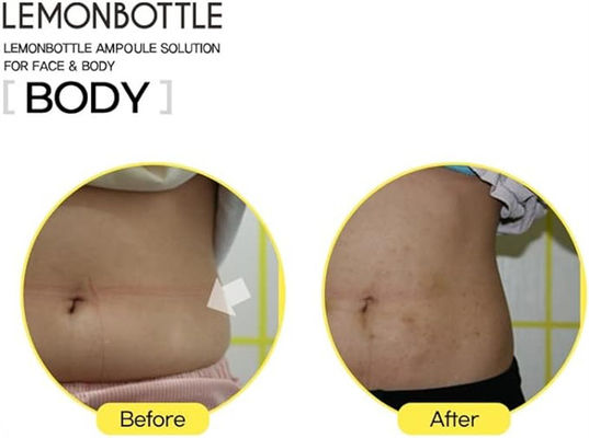 Zitronenflasche Lipolab Lipolyse Gewichtsverlust Fettverlust Zitronenflasche